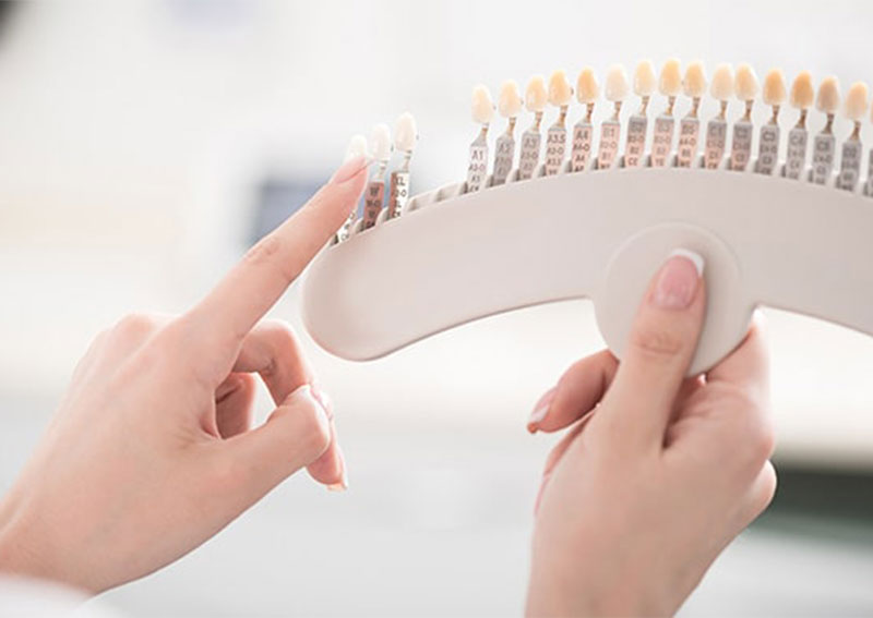 ホワイトニング